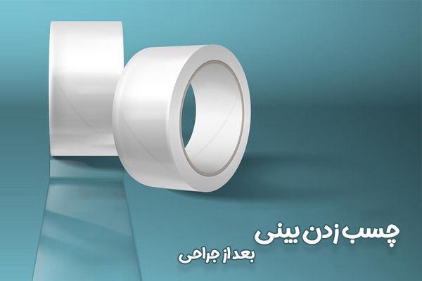 چسب زدن بینی بعد از جراحی - دکتر سهیلا رشیدی مهر