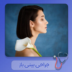جراحی بینی باز - دکتر سهیلا رشیدی مهر