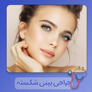 جراحی بینی شکسته - دکتر سهیلا رشیدی مهر در دزفول
