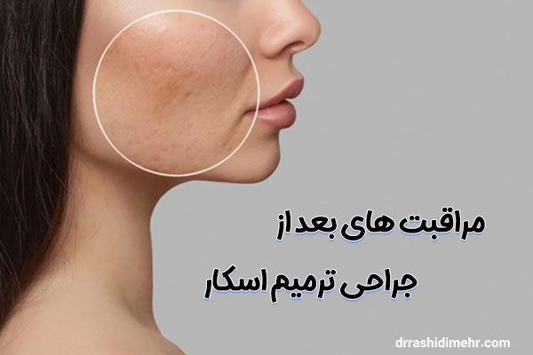 جراحی ترمیم اسکار یا زخم قدیمی - دکتر سهیلا رشیدی مهر