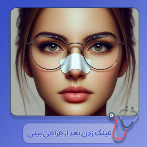 عینک زدن بعد از جراحی بینی - https://drrashidimehr.com/