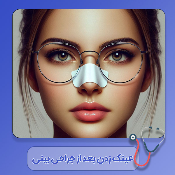 عینک زدن بعد از جراحی بینی - https://drrashidimehr.com/