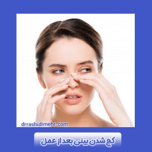 کج شدن بینی بعد از عمل