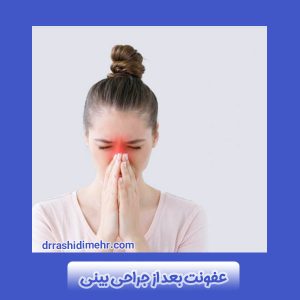 عفونت بعد از جراحی بینی