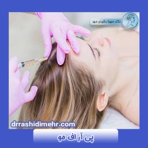 پی آر اف مو