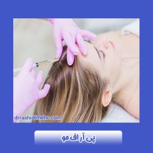 پی آر اف مو