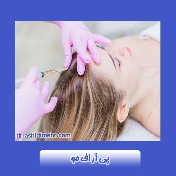 پی آر اف مو