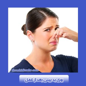 بوی بد بینی بعد از عمل