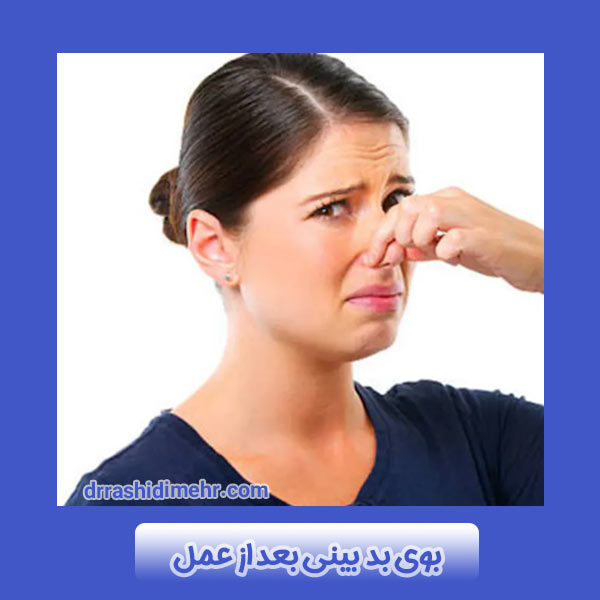 بوی بد بینی بعد از عمل