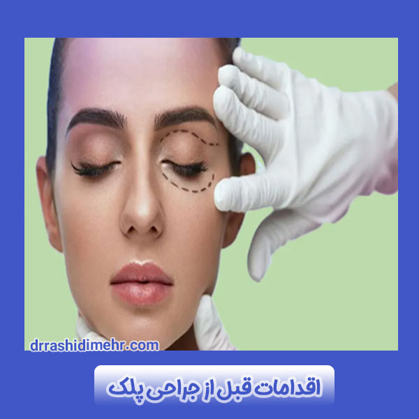 اقدامات قبل از جراحی پلک