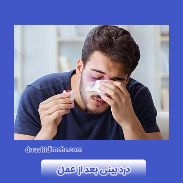 درد بینی بعد از عمل