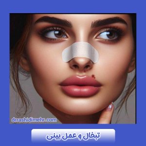 تبخال و عمل بینی