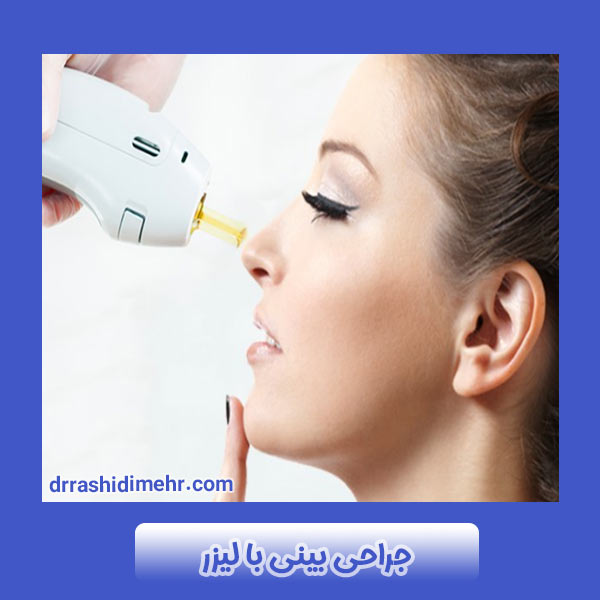 جراحی بینی با لیزر