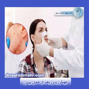 جوش زدن بعد از عمل بینی