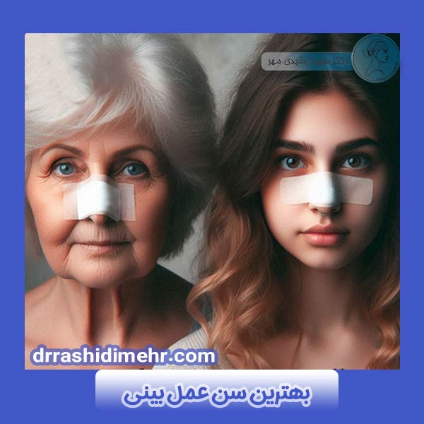بهترین سن عمل بینی