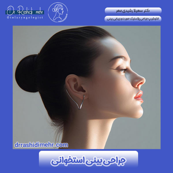 جراحی بینی استخوانی در دزفول