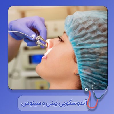 آندوسکوپی بینی و سینوس در دزفول - دکتر رشیدی مهر