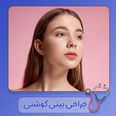 جراحی-بینی-گوشتی-در-دزفول جراحی بینی گوشتی در دزفول - دکتر رشیدی مهر