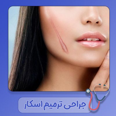 جراحی-ترمیم-اسکار جراحی ترمیم اسکار - دکتر سهیلا رشیدی مهر